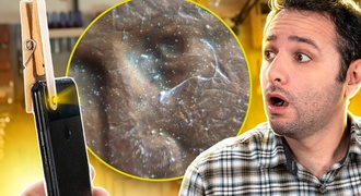 Microscópio com lente de laser